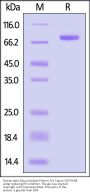 Human beta-Glucuronidase/GUSB Protein, His Tag (active enzyme)