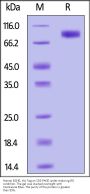 Human BCHE / Butyrylcholinesterase Protein, His Tag (active enzyme)