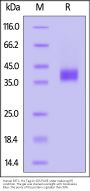 Human BST1 Protein, His Tag (MALS verified)
