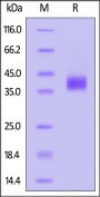 Human BST1 Protein, His Tag (MALS verified)
