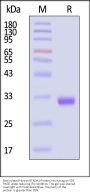 Biotinylated Human BTN3A1 / CD277 Protein, His,Avitag™