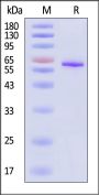 Human Catenin beta-1 Protein, His Tag (MALS verified)