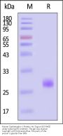 Human Cardiotrophin 1 Protein, His Tag (MALS verified)