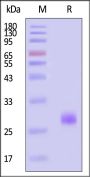 Human Cardiotrophin 1 Protein, His Tag (MALS verified)