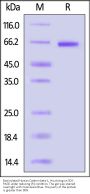 Biotinylated Human Catenin beta-1 Protein, His,Avitag™ (MALS verified)