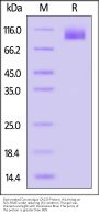 Biotinylated Cynomolgus CA125 / MUC16 Protein, His,Avitag™ (MALS verified)