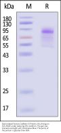 Biotinylated Human Cadherin-6 / KCAD / CDH6 Protein, His,Avitag™ (MALS verified)