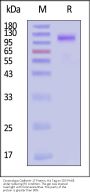 Cynomolgus Cadherin-17 / CDH17 Protein, His Tag (MALS verified)