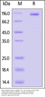 Biotinylated Human Cadherin-17 / CDH17 Protein, His,Avitag™ (MALS verified)