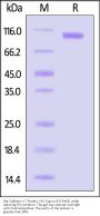 Rat Cadherin-17 / CDH17 Protein, His Tag (MALS verified)