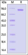 Rat Cadherin-17 / CDH17 Protein, His Tag (MALS verified)