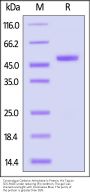 Cynomolgus Carbonic Anhydrase IX Protein, His Tag (MALS verified)