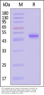 FITC-Labeled Human Carbonic Anhydrase IX / CA9 (38-414) Protein, His Tag (MALS verified)