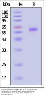 Human Cathepsin C Protein, His Tag (MALS verified)