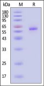 Human Cathepsin C Protein, His Tag (MALS verified)
