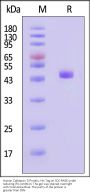 Human Cathepsin D Protein, His Tag (active enzyme, MALS verified)