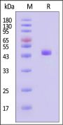 Human Cathepsin D Protein, His Tag (active enzyme, MALS verified)