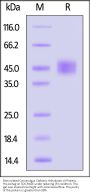 Biotinylated Cynomolgus Carbonic Anhydrase XII Protein, His,Avitag™ (active enzyme, MALS verified)