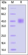 Biotinylated Cynomolgus Carbonic Anhydrase XII Protein, His,Avitag™ (active enzyme, MALS verified)