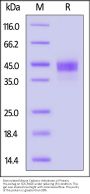 Biotinylated Mouse Carbonic Anhydrase XII Protein, His,Avitag™ (active enzyme, MALS verified)
