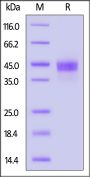 Biotinylated Mouse Carbonic Anhydrase XII Protein, His,Avitag™ (active enzyme, MALS verified)