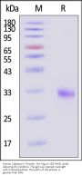 Human Cathepsin L / CTSL1 Protein, His Tag (active enzyme)