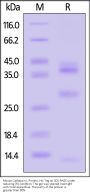 Mouse Cathepsin L / CTSL1 Protein, His Tag (MALS verified)