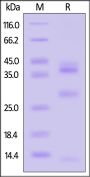 Mouse Cathepsin L / CTSL1 Protein, His Tag (MALS verified)