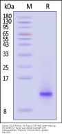 Human CCL20 Protein, His Tag (HPLC verified)