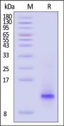 Human CCL20 Protein, His Tag (HPLC verified)