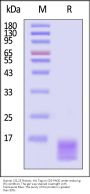 Human CCL23 Protein, His Tag (MALS verified)