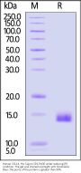 Human CCL14 / HCC-1 Protein, His Tag