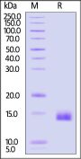 Human CCL14 / HCC-1 Protein, His Tag