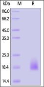 Human CCL24/Eotaxin-2 Protein, His Tag (HPLC verified)
