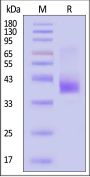 Mouse CCR5 Protein, Flag,His Tag (Detergent)