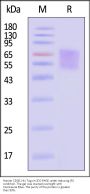 Human CD30 / TNFRSF8 Protein, His Tag