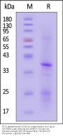 FITC-Labeled Human CD20 / MS4A1 Full Length Protein, His Tag (Nanodisc, SPR verified)