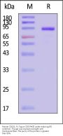 Human IL-3 R Beta / CD131 Protein, Fc Tag (MALS verified)