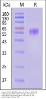 Human CDCP1 (30-368) Protein, His Tag (MALS verified)