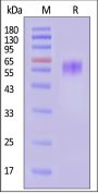 Human CDCP1 (30-368) Protein, His Tag (MALS verified)