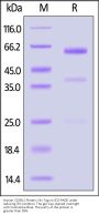 Human CD39L1 / ENTPD2 Protein, His Tag (active enzyme, MALS verified)