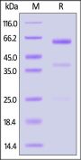 Human CD39L1 / ENTPD2 Protein, His Tag (active enzyme, MALS verified)