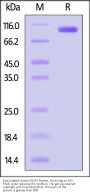 Biotinylated Human CDCP1 Protein, His,Avitag™ (MALS verified)