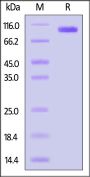 Biotinylated Human CDCP1 Protein, His,Avitag™ (MALS verified)