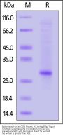 Biotinylated Human CD81 Protein, His,Avitag™&Flag Tag (Detergent)
