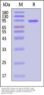 Mouse CDCP1 Protein, His Tag (MALS verified)
