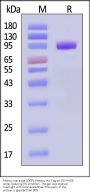 Rhesus macaque CDCP1 Protein, His Tag (MALS verified)
