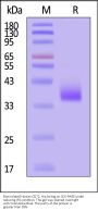 Biotinylated Human CD72 Protein, His,Avitag™ (MALS verified)