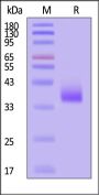 Biotinylated Human CD72 Protein, His,Avitag™ (MALS verified)