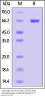 Human Siglec-3 / CD33 (R119G) Protein, Fc Tag